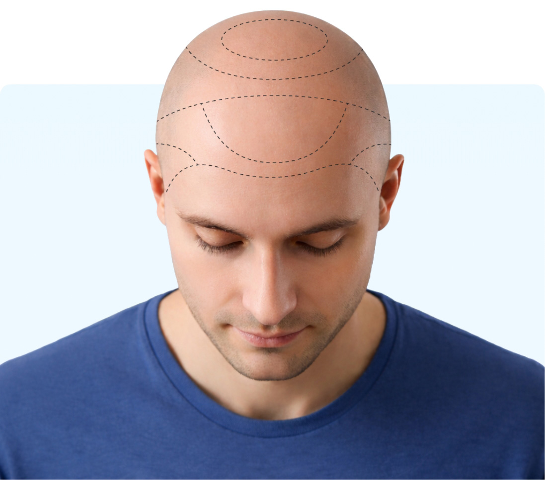 Kalkulačka štěpů